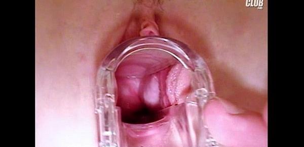  Nia gyno pussy speculum exam at clinic